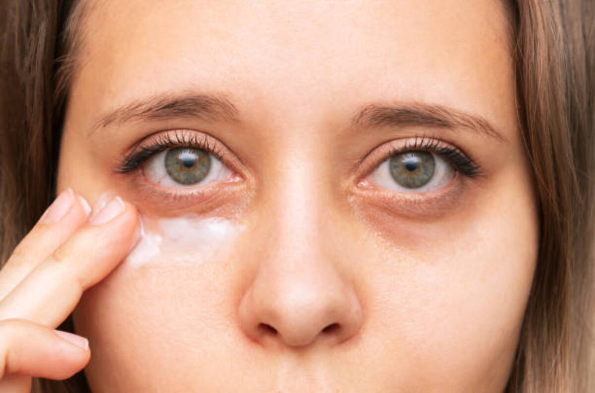 Belleza: Te mostramos cómo puedes disminuir las ojeras