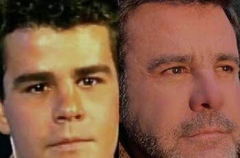 Eduardo Capetillo víctima de cáncer de piel