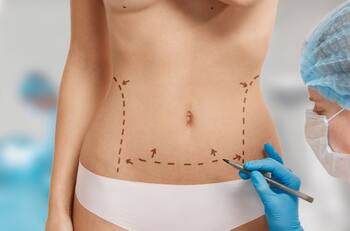 La ‘narcoestética’ una práctica usual entre las mujeres de Sinaloa