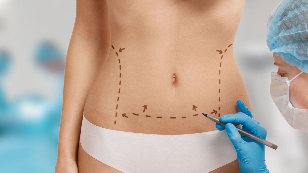 La ‘narcoestética’ una práctica usual entre las mujeres de Sinaloa