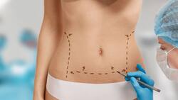 La ‘narcoestética’ una práctica usual entre las mujeres de Sinaloa