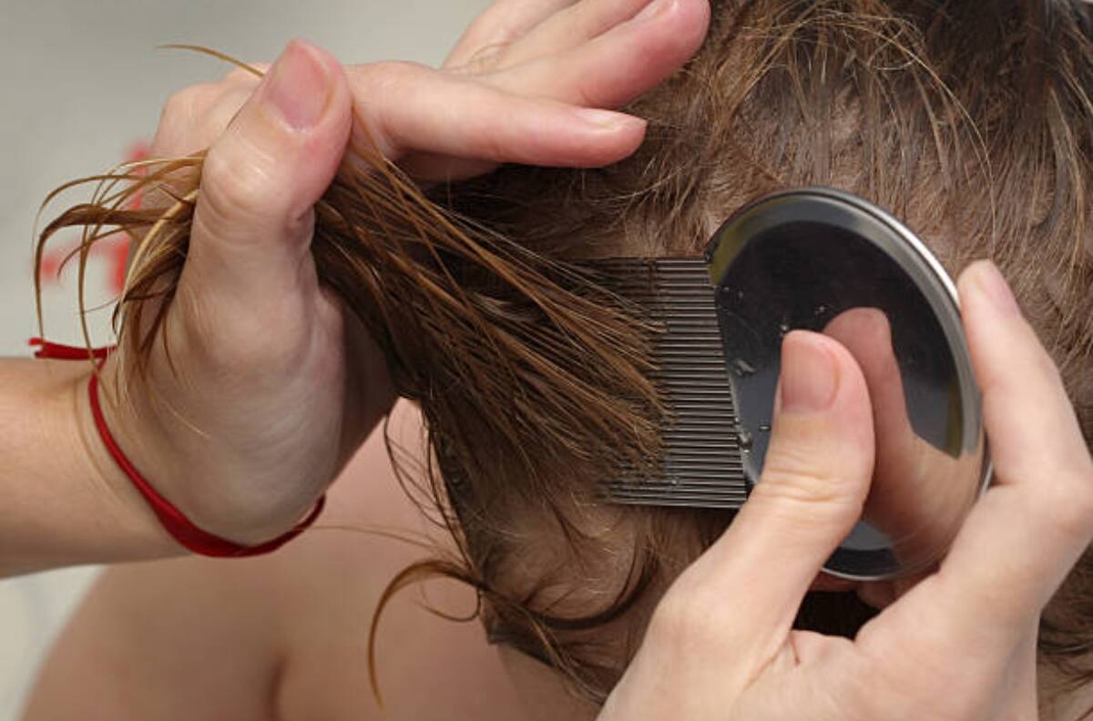 Salud: Estos son algunos remedios para acabar con los piojos