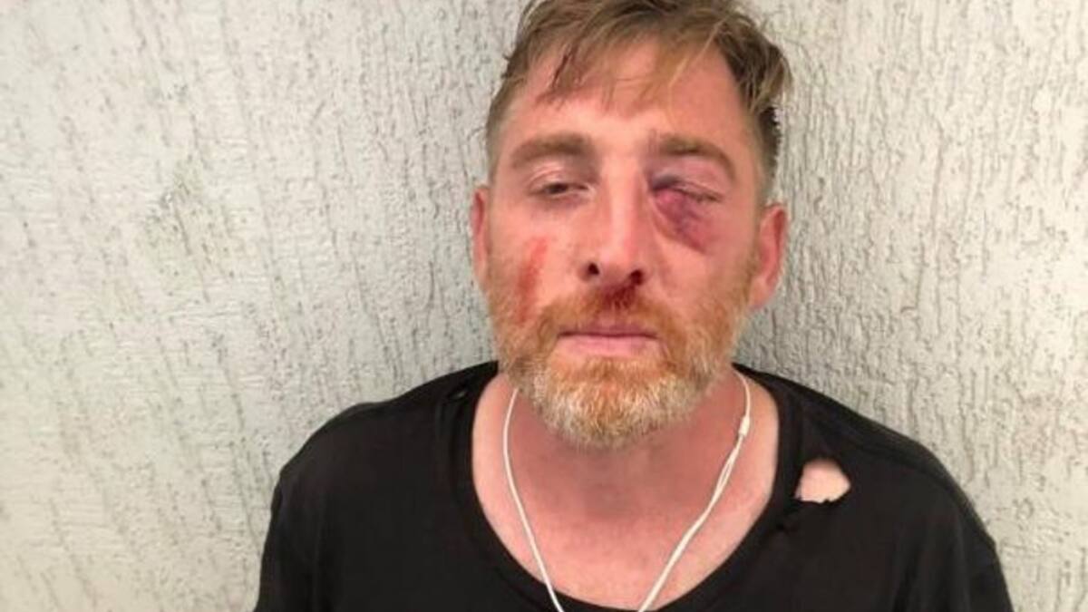 Camarógrafo de Georgia muere por golpes de una turba homófoba