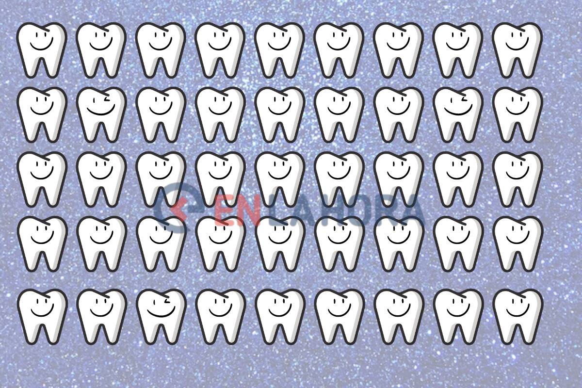 Encuentra los dientes que son diferentes al resto.