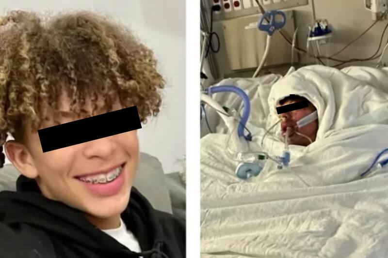 Adolescente resulta gravemente herido por reto viral de TikTok.