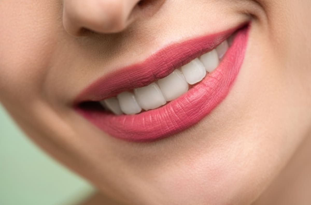 Alimentos que te ayudan a tener dientes más blancos
