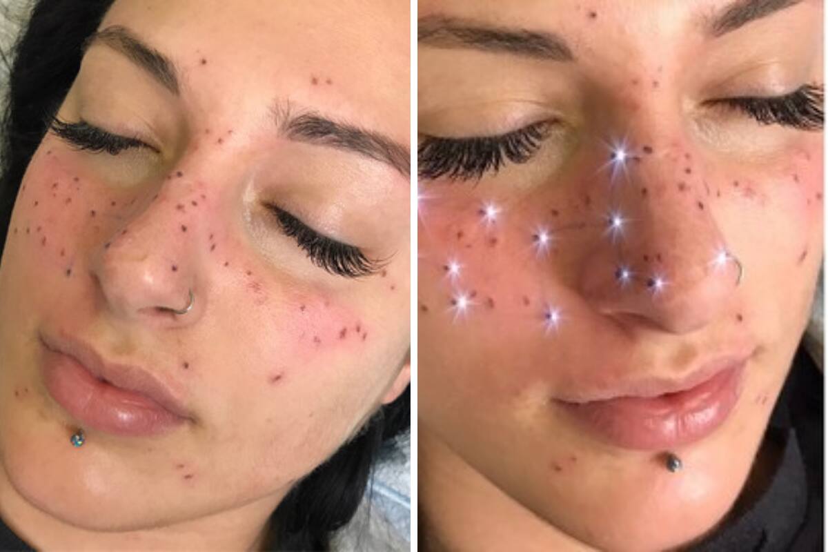 Tatuaje de pecas.