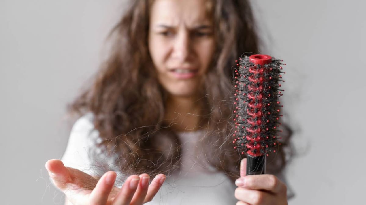 Las vitaminas que ayudan a prevenir la caída del pelo