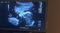 VIDEO | Captan a feto “cantando” durante ultrasonido y sorprende a todos en redes sociales