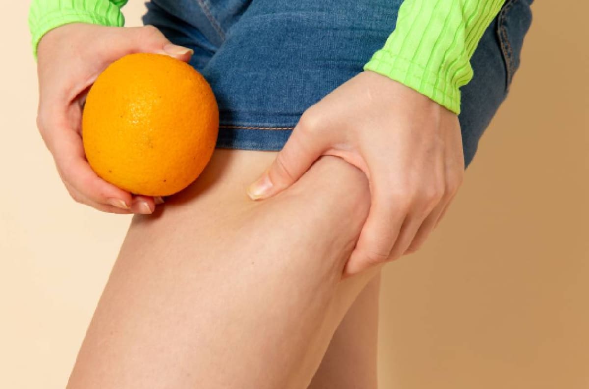 Elimina la celulitis de tus piernas de manera 100% natural