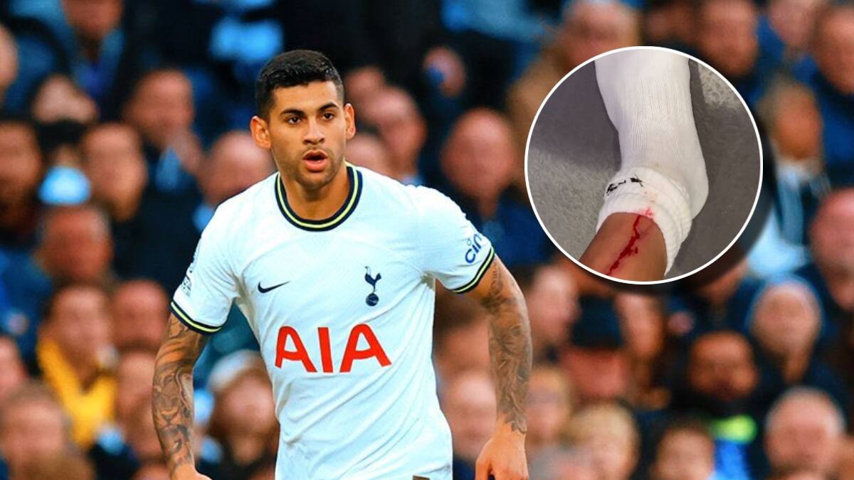 VIDEO | Cuti Romero le abrió la pierna a un compañero del Tottenham en la pretemporada