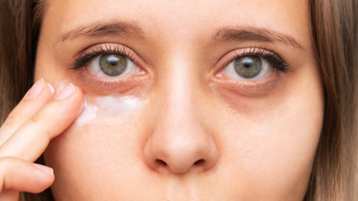 Conoce este remedio natural para disminuir las ojeras