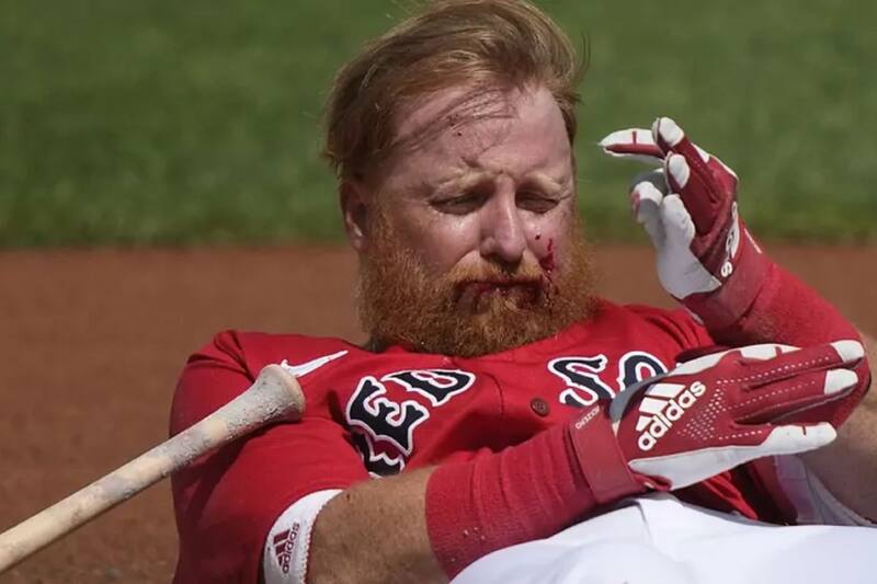 Justin Turner fue inmediatamente trasladado a un hospital.