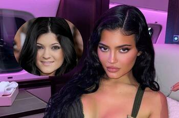 Kylie Jenner niega haberse hecho cirugías para cambiar la apariencia de su rostro