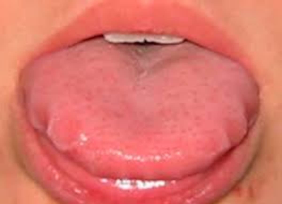 No siempre tener una lengua roja es indicativo de buena salud.