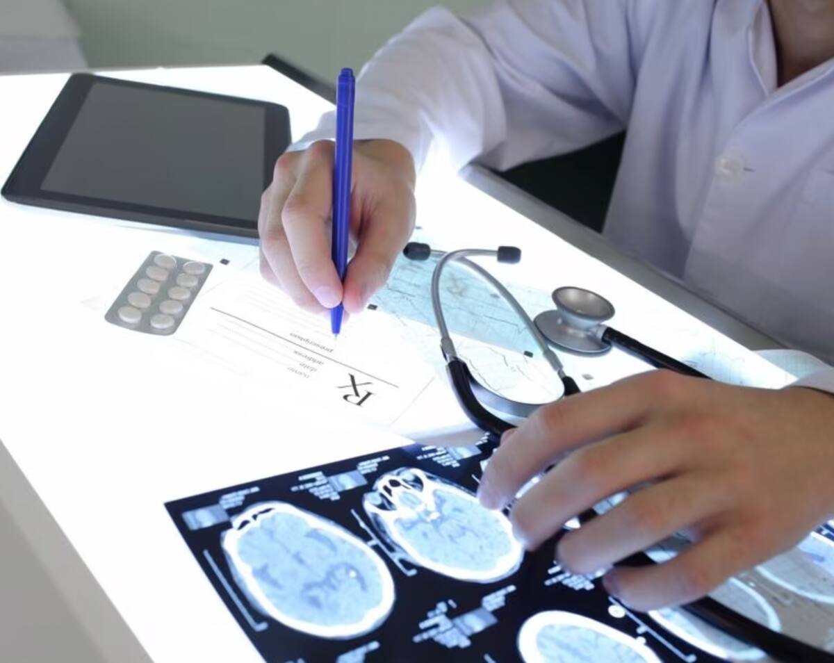 Se descubrió que el Vorasidenib puede frenar los gliomas.