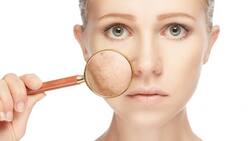 Elimina las manchas de sol con estos remedios caseros sencillos y baratos