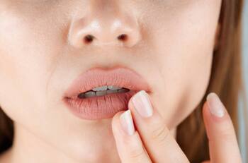 Estos son 5 alimentos que resecan tus labios ¡Evítalos!!