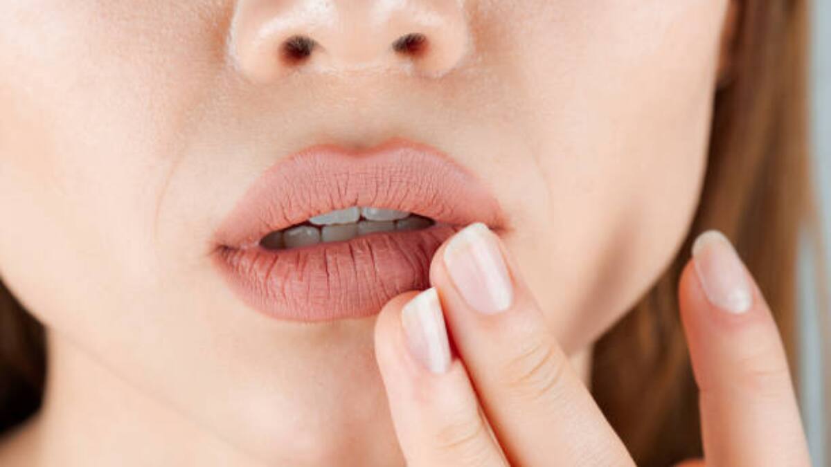 Estos son 5 alimentos que resecan tus labios ¡Evítalos!!