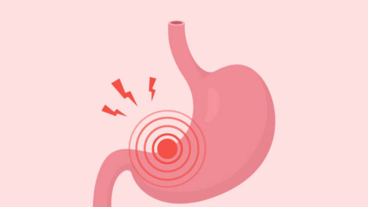 Estos son los alimentos que debes eliminar de tu dieta si padeces gastritis