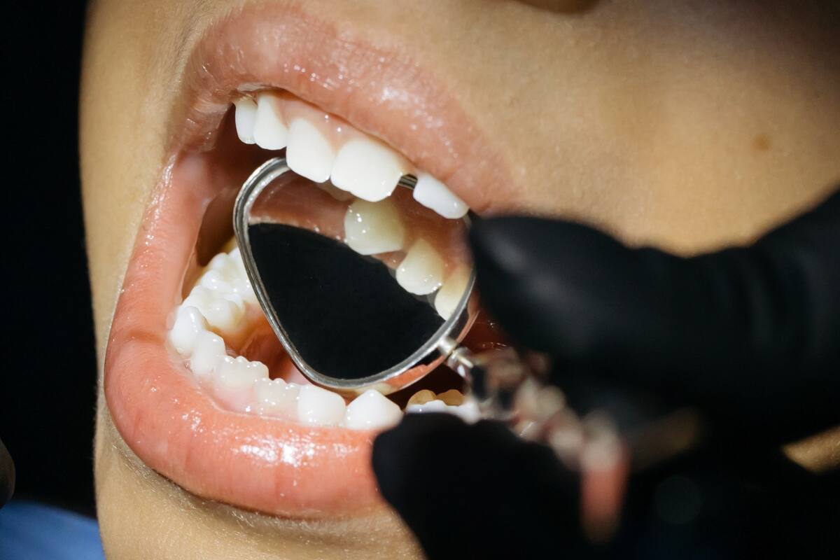 Crean medicamento que regenera los dientes (Foto: Freepik)