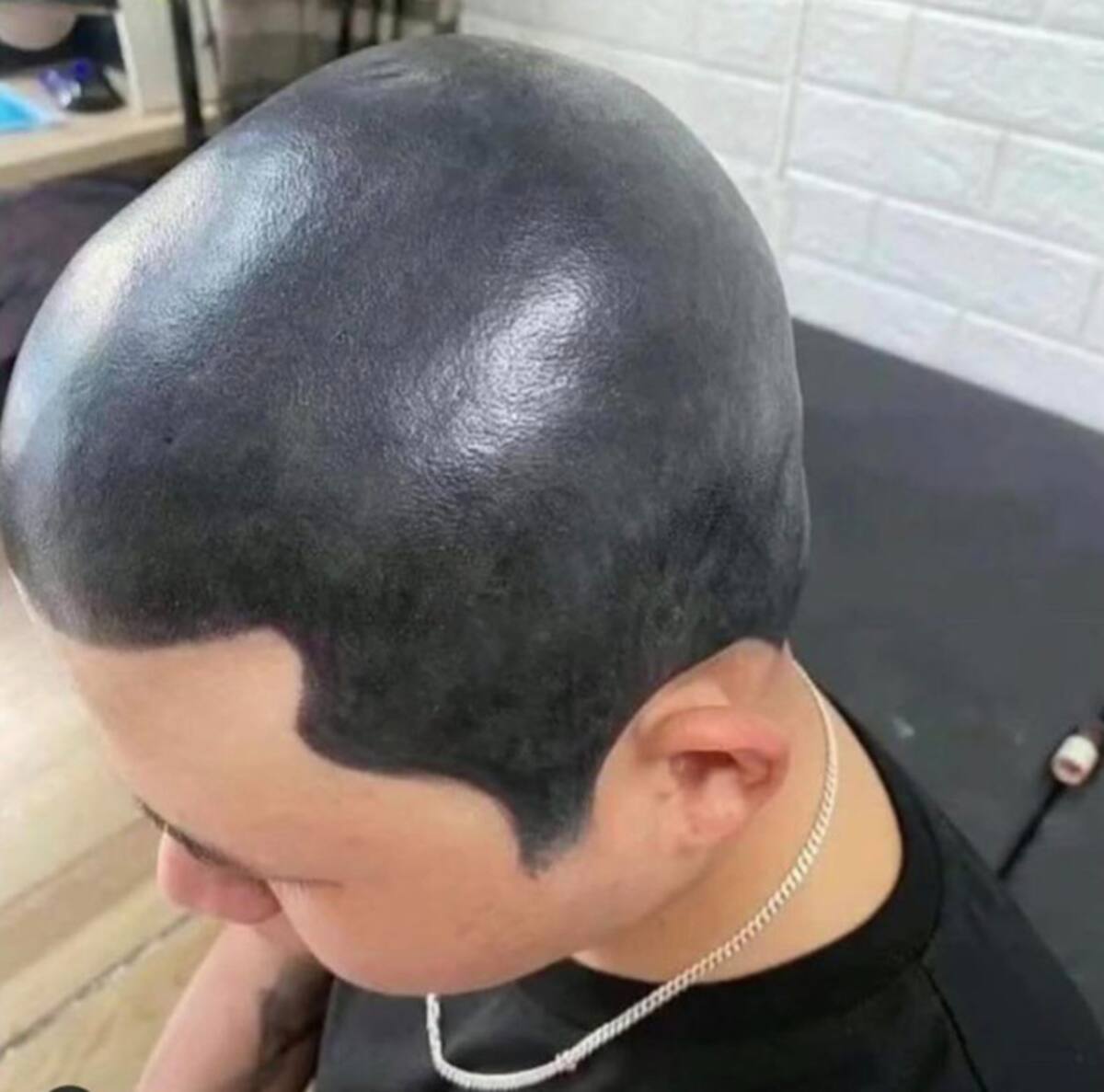 Tatuaje para combatir la calvicie.